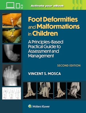 Mosca, Vincent. Foot Deformities and Malformations in Children - A Principles-Based, Practical Guide to Assessment and Management: Print + eBook with Multimedia. Lippincott Williams&Wilki, 2025.