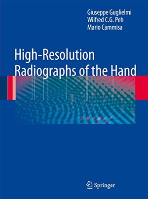 Guglielmi, Giuseppe / Cammisa, Mario et al. High-Resolution Radiographs of the Hand. Springer Berlin Heidelberg, 2010.