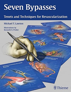 Lawton, Michael T.. Seven Bypasses - Tenets and Techniques for Revascularization. Thieme Medical Publishers, 2018.