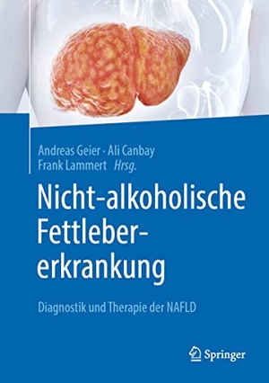 Geier, Andreas / Frank Lammert et al (Hrsg.). Nicht-alkoholische Fettlebererkrankung - Diagnostik und Therapie der NAFLD. Springer Berlin Heidelberg, 2022.