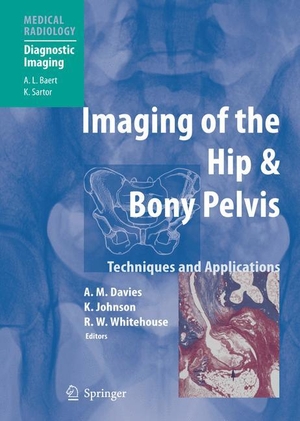 Davies, A. Mark / Richard William Whitehouse et al (Hrsg.). Imaging of the Hip & Bony Pelvis - Techniques and Applications. Springer Berlin Heidelberg, 2010.