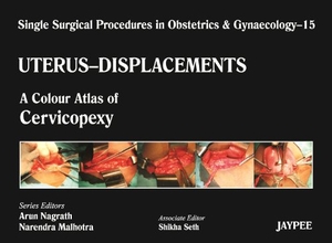 Nagrath, Arun / Malhotra, Narendra et al. Single Surgical Procedures in Obstetrics and Gynaecology - Volume 15 - UTERUS - DISPLACEMENTS - A Colour Atlas of Cervicopexy (Purandare's). Jaypee Brothers Medical Publishers Pvt Ltd, 2012.