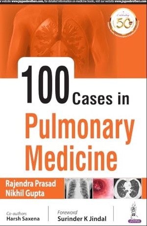 Prasad, Rajendra. 100 Cases in Pulmonary Medicine. Jaypee Brothers Medical Publishers Pvt Ltd, 2021.