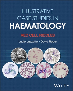 Roper, David R. / Lucio Luzzatto. Illustrative Case Studies in Haematology - Red Cell Riddles. John Wiley & Sons Inc, 2026.