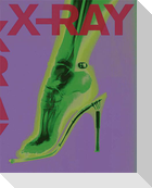 X-RAY