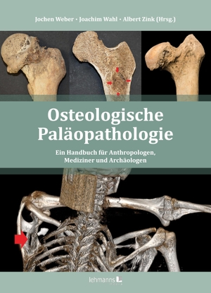 Weber, Jochen / Joachim Wahl et al (Hrsg.). Osteologische Paläopathologie - Ein Handbuch für Anthropologen, Mediziner und Archäologen. Lehmanns Media GmbH, 2022.