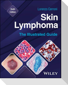 Skin Lymphoma