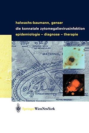 Genser, Bernd / Gabriele Halwachs-Baumann. Die konnatale Zytomegalievirusinfektion - Epidemiologie - Diagnose - Therapie. Springer Vienna, 2003.