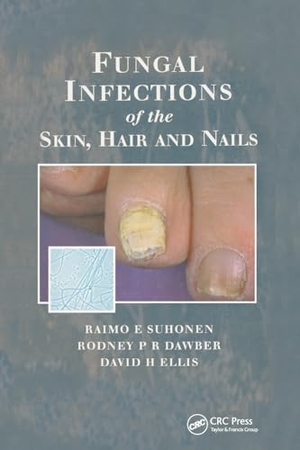 Suhonen, Raimo E / Dawber, Rodney P R et al. Fungal Infections of the Skin and Nails. Taylor & Francis Ltd (Sales), 2019.