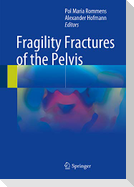 Fragility Fractures of the Pelvis