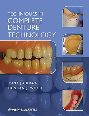 Johnson. Techniques in Complete Denture. John Wiley & Sons, 2012.