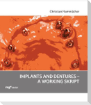 Implants and dentures - a working skript