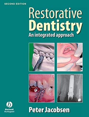 Jacobsen. Restorative Dentistry 2e. John Wiley & Sons, 2008.