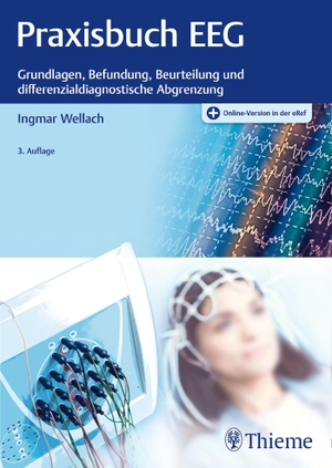 Wellach, Ingmar. Praxisbuch EEG - Grundlagen, Befundung, Beurteilung und differenzialdiagnostische Abgrenzung. Georg Thieme Verlag, 2020.