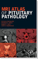 MRI Atlas of Pituitary Pathology
