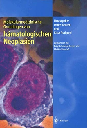 Ruckpaul, Klaus / Detlev Ganten (Hrsg.). Molekularmedizinische Grundlagen von hämatologischen Neoplasien. Springer Berlin Heidelberg, 2011.