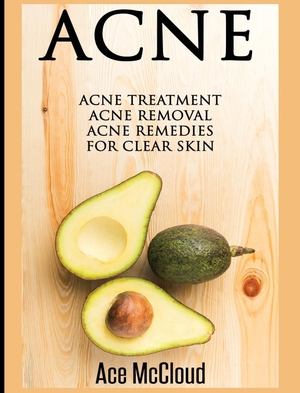 Mccloud, Ace. Acne - Acne Treatment: Acne Removal: Acne Remedies For Clear Skin. Pro Mastery Publishing, 2017.