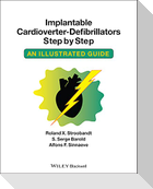 Implantable Cardioverter - Defibrillators Step by Step