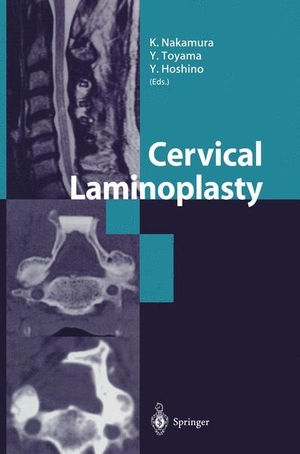 Nakamura, K. / Y. Hoshino et al (Hrsg.). Cervical Laminoplasty. Springer Japan, 2003.