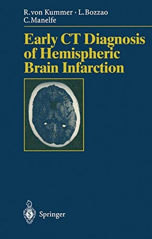 Kummer, Rüdiger V. / Bozzao, Luigi et al. Early CT Diagnosis of Hemispheric Brain Infarction. Springer, 1995.