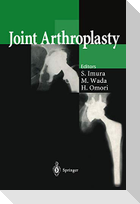 Joint Arthroplasty