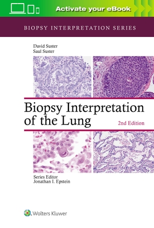 Suster, Saul / David Suster. Biopsy Interpretation of the Lung - Biopsy Interpretation Series. Lippincott Williams&Wilki, 2020.