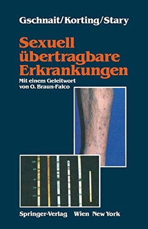Gschnait, Fritz / Stary, Angelika et al. Sexuell übertragbare Erkrankungen. Springer Vienna, 1990.