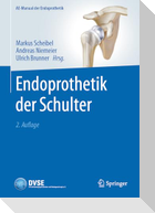 Endoprothetik der Schulter