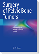 Surgery of Pelvic Bone Tumors