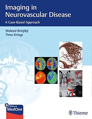 Brinjikji, Waleed / Timo Krings. Imaging in Neurovascular Disease - A Case-Based Approach. Thieme Publishers New York, 2019.
