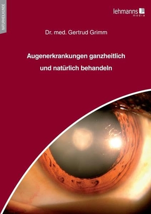 Grimm, Gertrud. Augenerkrankungen ganzheitlich und natürlich behandeln. Lehmanns Media GmbH, 2022.