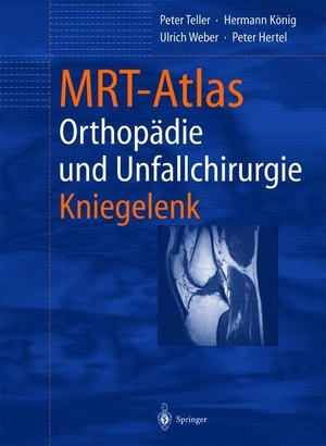Peter Teller / B. Hamm / Hermann König / Ulrich Weber / Peter Hertel. MRT-Atlas Orthopädie und Unfallchirurgie - Kniegelenk. Springer Berlin, 2012.