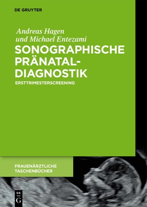Andreas Hagen / Michael Entezami. Sonographische Pränataldiagnostik - Ersttrimesterscreening. De Gruyter, 2018.