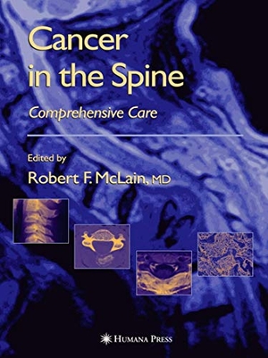 McLain, Robert F. / Maurie Markman et al (Hrsg.). Cancer in the Spine - Comprehensive Care. Humana Press, 2010.