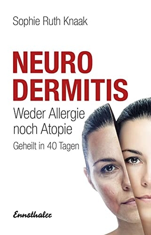 Knaak, Sophie Ruth. Neurodermitis - Weder Allergie noch Atopie. Geheilt in 40 Tagen. Ennsthaler GmbH + Co. Kg, 2017.