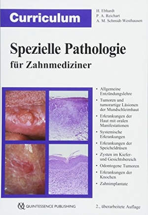 Ebhardt, Harald / Reichart, Peter A. et al. Curriculum Spezielle Pathologie für Zahnmediziner. Quintessenz Verlags-GmbH, 2018.