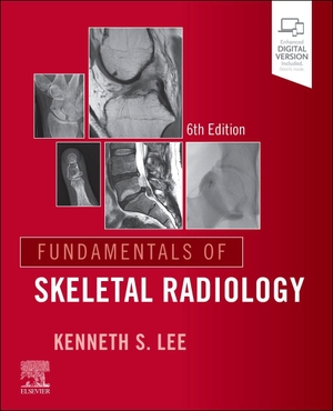 Lee, Kenneth S. Fundamentals of Skeletal Radiology. Elsevier LTD, 2026.