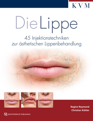 Reymond, Regine / Christian Köhler. Die Lippe - 45 Injektionstechniken zur ästhetischen Lippenbehandlung. KVM-Der Medizinverlag, 2020.