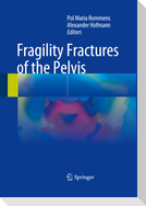 Fragility Fractures of the Pelvis