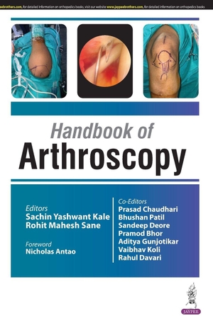 Kale, Sachin Yashwant / Rohit Mahesh Sane. Handbook of Arthroscopy. Jaypee Brothers Medical Publishers Pvt Ltd, 2025.