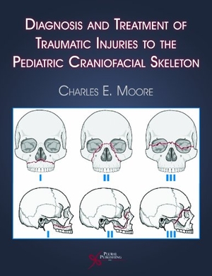 Moore, Charles E. Diagnosis and Treatment of Traumatic Injuries to the Pediatric Craniofacial Skeleton. Plural Publishing - IPSUK, 2007.