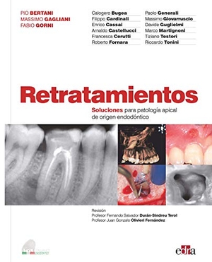 Bugea / Cardinali, Calogero et al. Retratamientos. Soluciones Para Patología Apical de Origen Endodóntico. Edra, 2020.