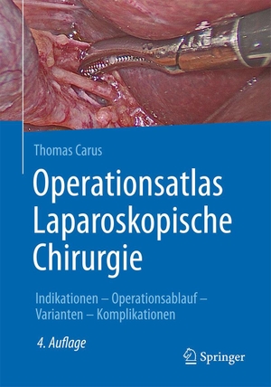 Carus, Thomas. Operationsatlas Laparoskopische Chirurgie - Indikationen - Operationsablauf - Varianten - Komplikationen. Springer-Verlag GmbH, 2021.