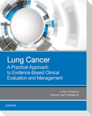 Lung Cancer: A Practical Approach to Evidence-Based Clinical Evaluation and Management