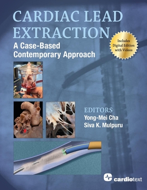 Cha, Yong-Mei / Siva K. Mulpuru (Hrsg.). Cardiac Lead Extraction - A Case-Based Contemporary Approach. Cardiotext Publishing, 2021.