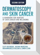 Dermatoscopy and Skin Cancer, second edition