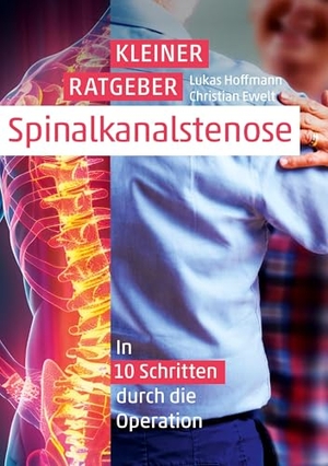 Hoffmann, Lukas. Kleiner Ratgeber Spinalkanalstenose - In 10 Schritten durch die Operation. via tolino media, 2024.