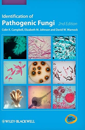 Campbell. Identification of Pathogenic F. John Wiley & Sons, 2013.