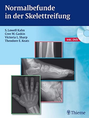 Kahn, S. Lowell / Gaskin, Cree M. et al. Normalbefunde in der Skelettreifung. Georg Thieme Verlag, 2012.