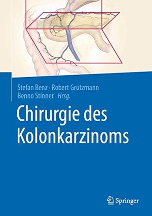 Benz, Stefan / Robert Grützmann et al (Hrsg.). Chirurgie des Kolonkarzinoms. Springer, 2021.